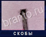 Что под микроскопом - ответы на все уровни игры